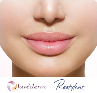 Lip Augmentation